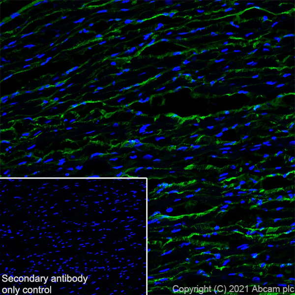 Immunohistochemistry (Frozen sections) - Anti-Pro-Collagen III alpha 1 antibody [RM1028] (AB283694)