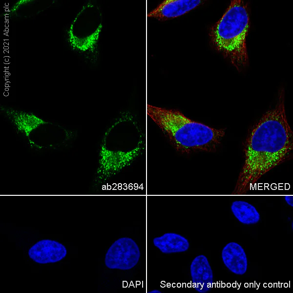 Immunocytochemistry/ Immunofluorescence - Anti-Pro-Collagen III alpha 1 antibody [RM1028] - BSA and Azide free (AB283725)