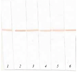 Western blot - Anti-proBNP antibody [5B6] (AB13111), expandable thumbnail