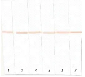 Western blot - Anti-proBNP antibody [5B6] (AB13111)