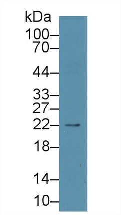 Western blot - Anti-proBNP antibody [C1] (AB239514), expandable thumbnail
