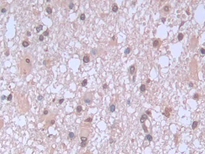 Immunohistochemistry (Formalin/PFA-fixed paraffin-embedded sections) - Anti-proBNP antibody [C11] (AB239519), expandable thumbnail