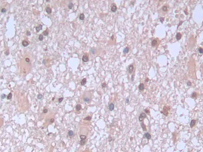 Immunohistochemistry (Formalin/PFA-fixed paraffin-embedded sections) - Anti-proBNP antibody [C11] (AB239519)