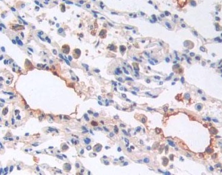 Immunohistochemistry (Formalin/PFA-fixed paraffin-embedded sections) - Anti-proBNP antibody [C11] (AB239519), expandable thumbnail