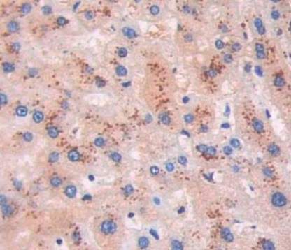 Immunohistochemistry (Formalin/PFA-fixed paraffin-embedded sections) - Anti-proBNP antibody [C11] (AB239519), expandable thumbnail