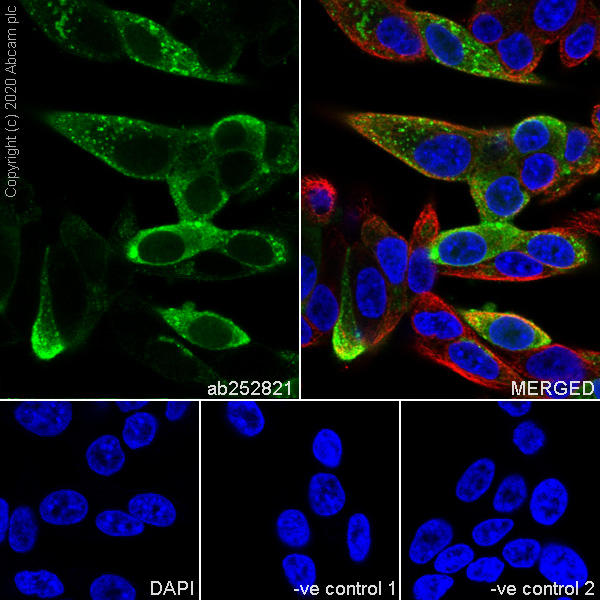Immunocytochemistry/ Immunofluorescence - Anti-Procalcitonin antibody [4A6] (AB252821), expandable thumbnail