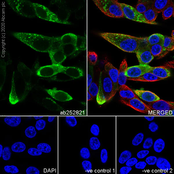 Immunocytochemistry/ Immunofluorescence - Anti-Procalcitonin antibody [4A6] (AB252821)
