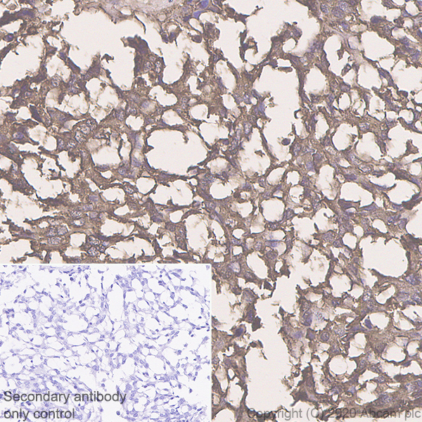 Immunohistochemistry (Formalin/PFA-fixed paraffin-embedded sections) - Anti-Procalcitonin antibody [4A6] (AB252821), expandable thumbnail