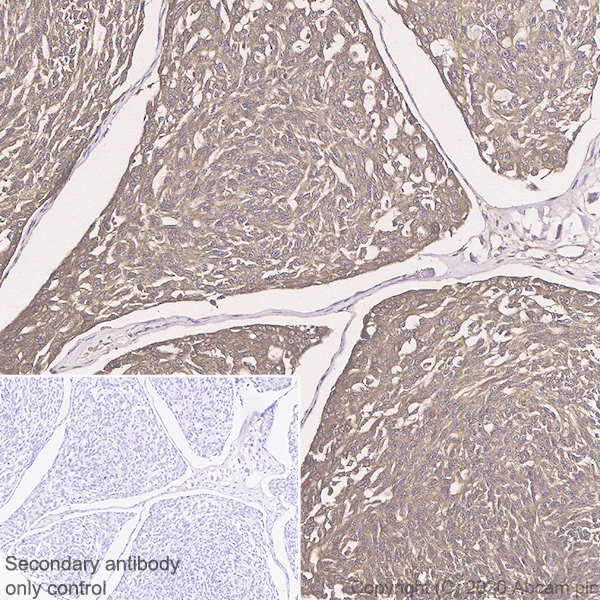 Immunohistochemistry (Formalin/PFA-fixed paraffin-embedded sections) - Anti-Procalcitonin antibody [4A6] (AB252821), expandable thumbnail