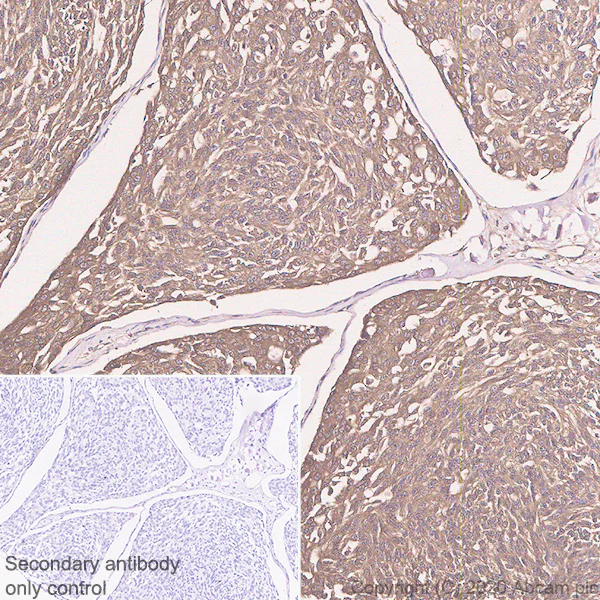 Immunohistochemistry (Formalin/PFA-fixed paraffin-embedded sections) - Anti-Procalcitonin antibody [4A6] (AB252821)