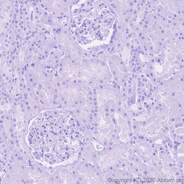 Immunohistochemistry (Formalin/PFA-fixed paraffin-embedded sections) - Anti-Procalcitonin antibody [4A6] (AB252821), expandable thumbnail
