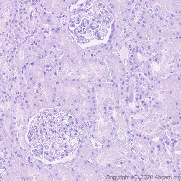 Immunohistochemistry (Formalin/PFA-fixed paraffin-embedded sections) - Anti-Procalcitonin antibody [4A6] - BSA and Azide free (AB255777)