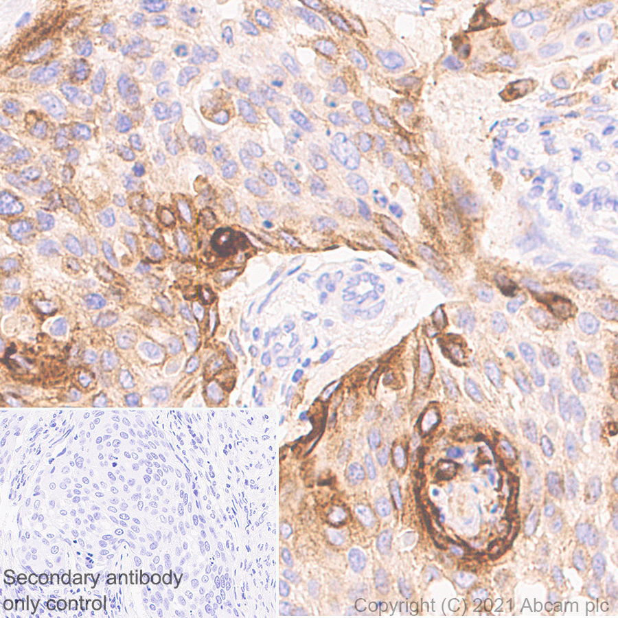 Immunohistochemistry (Formalin/PFA-fixed paraffin-embedded sections) - Anti-ProCathepsin B antibody [EPR24353-25] (AB270998)