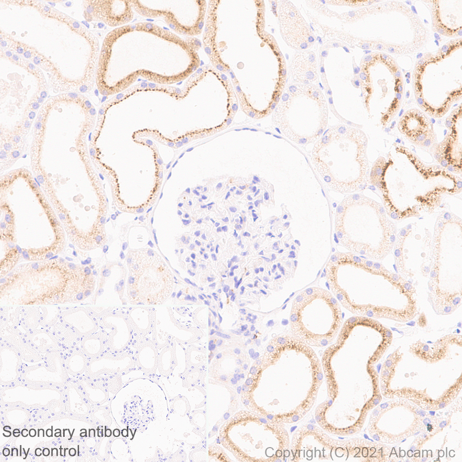 Immunohistochemistry (Formalin/PFA-fixed paraffin-embedded sections) - Anti-ProCathepsin B antibody [EPR24353-25] (AB270998)