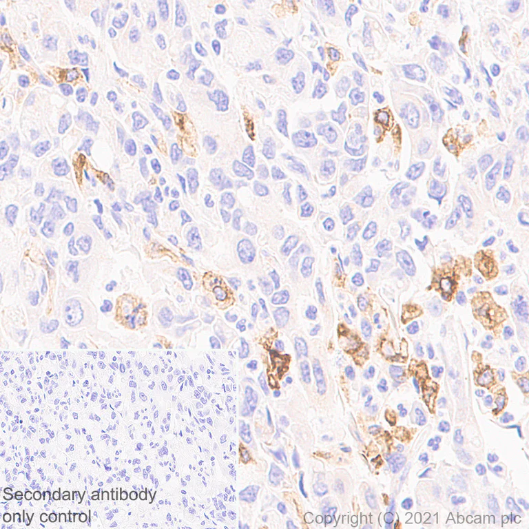 Immunohistochemistry (Formalin/PFA-fixed paraffin-embedded sections) - Anti-ProCathepsin B antibody [EPR24353-25] - BSA and Azide free (AB282287)