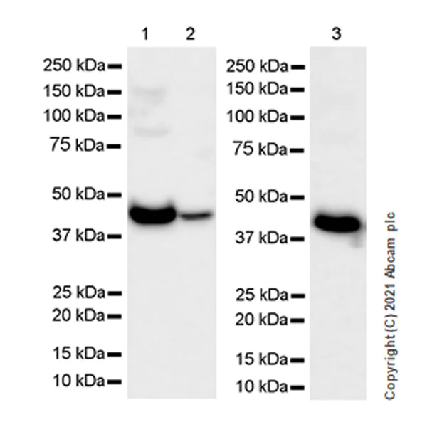 Western blot - Anti-ProCathepsin B antibody [EPR24353-25] - BSA and Azide free (AB282287)