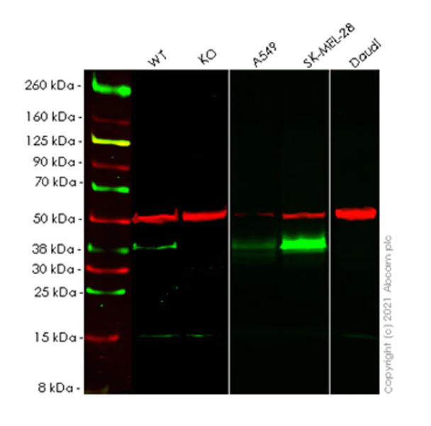 Western blot - Anti-ProCathepsin B antibody [EPR24353-25] - BSA and Azide free (AB282287)