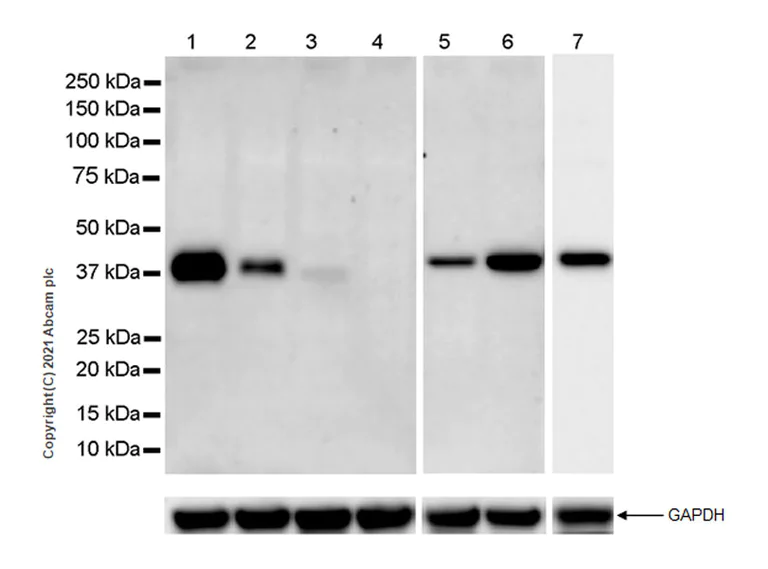 Western blot - Anti-ProCathepsin B antibody [EPR24353-25] - BSA and Azide free (AB282287)