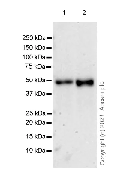 Western blot - Anti-proCathepsin D antibody [EPR24352-13] (AB270999)
