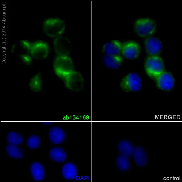 Immunocytochemistry/ Immunofluorescence - Anti-proCathepsin D antibody [EPR3054] (AB134169)