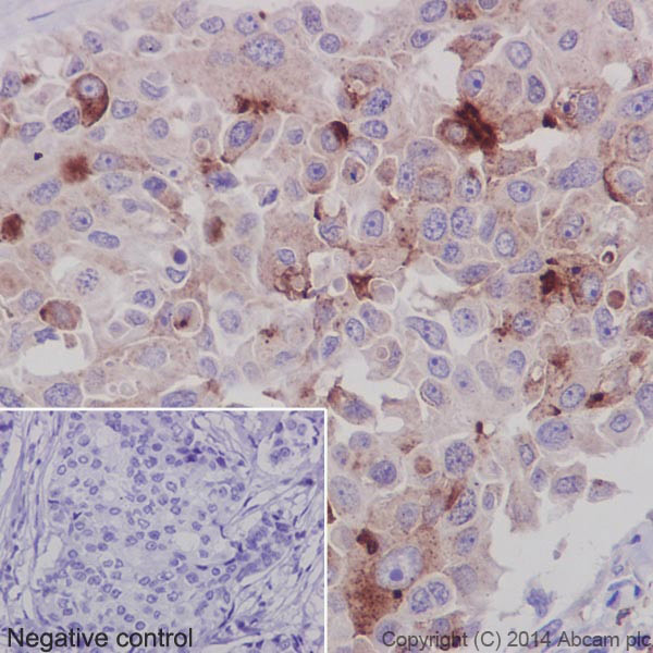 Immunohistochemistry (Formalin/PFA-fixed paraffin-embedded sections) - Anti-proCathepsin D antibody [EPR3054] (AB134169), expandable thumbnail