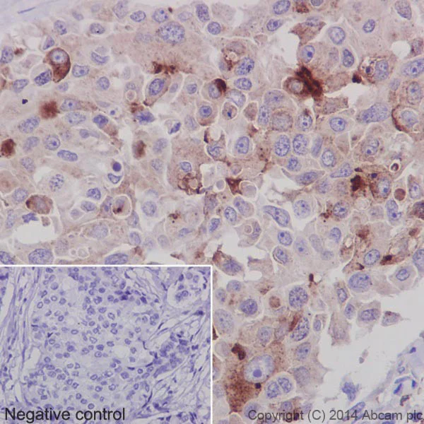 Immunohistochemistry (Formalin/PFA-fixed paraffin-embedded sections) - Anti-proCathepsin D antibody [EPR3054] (AB134169)