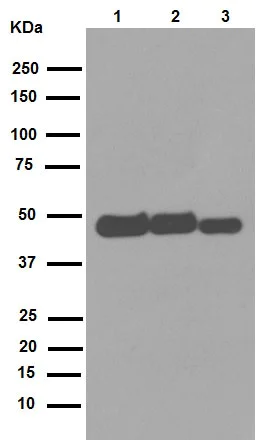 Western blot - Anti-proCathepsin D antibody [EPR3054] (AB134169)
