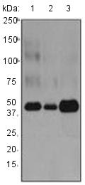 Western blot - Anti-proCathepsin D antibody [EPR3054] (ab134169), expandable thumbnail