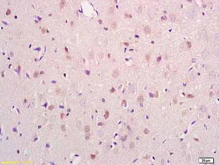 Immunohistochemistry (Formalin/PFA-fixed paraffin-embedded sections) - Anti-PRODH antibody (AB203875)