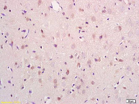Immunohistochemistry (Formalin/PFA-fixed paraffin-embedded sections) - Anti-PRODH antibody (AB203875)