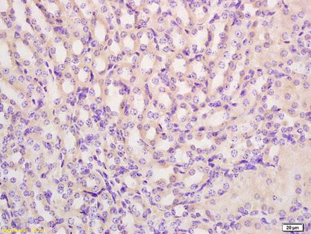 Immunohistochemistry (Formalin/PFA-fixed paraffin-embedded sections) - Anti-PRODH antibody (AB203875)