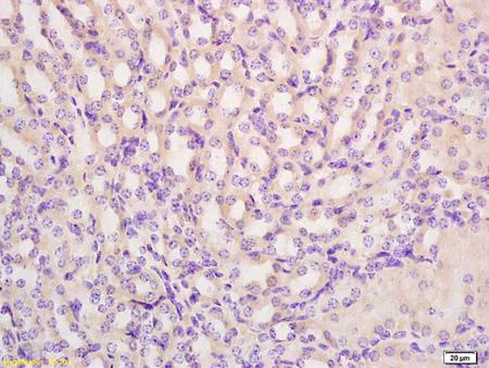 Immunohistochemistry (Formalin/PFA-fixed paraffin-embedded sections) - Anti-PRODH antibody (AB203875)