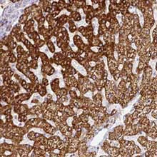 Immunohistochemistry (Formalin/PFA-fixed paraffin-embedded sections) - Anti-PRODH2 antibody (AB151130)