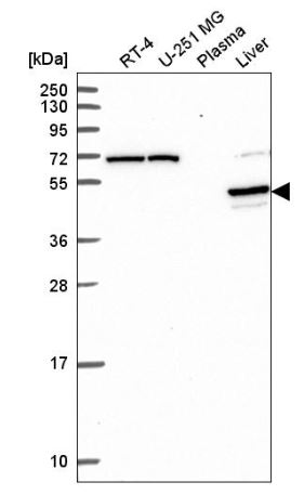 Western blot - Anti-PRODH2 antibody (AB151130), expandable thumbnail