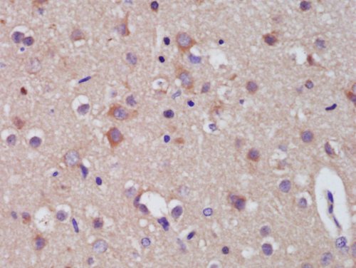 Immunohistochemistry (Formalin/PFA-fixed paraffin-embedded sections) - Anti-ProDynorphin antibody (AB217160)
