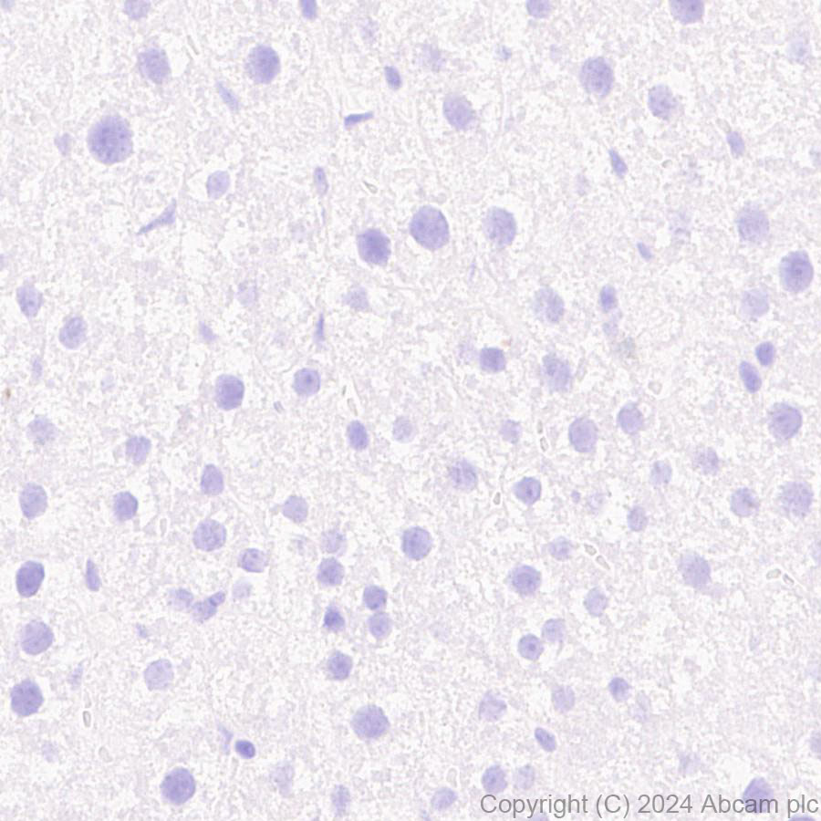 Immunohistochemistry (Formalin/PFA-fixed paraffin-embedded sections) - Anti-ProDynorphin antibody [EPR28632-48] (ab318966), expandable thumbnail