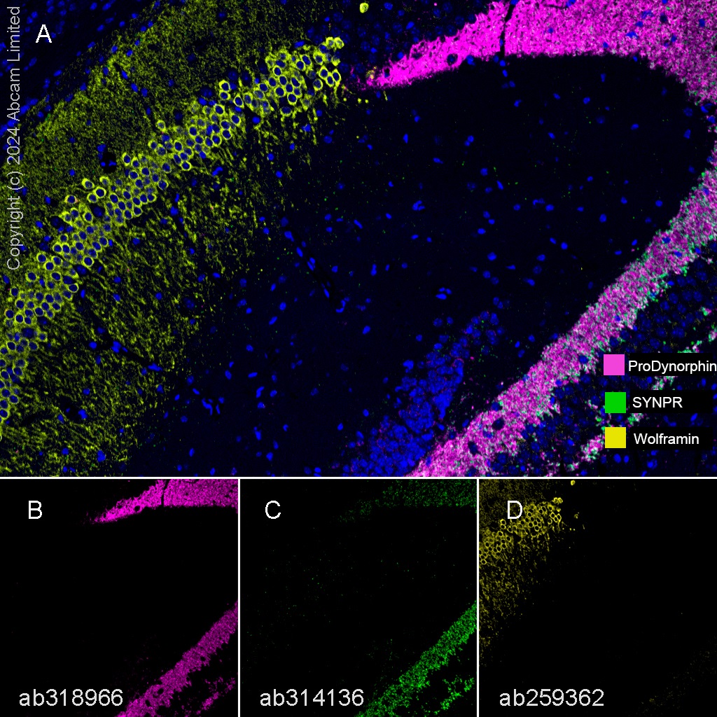 Multiplex immunohistochemistry - Anti-ProDynorphin antibody [EPR28632-48] (ab318966), expandable thumbnail