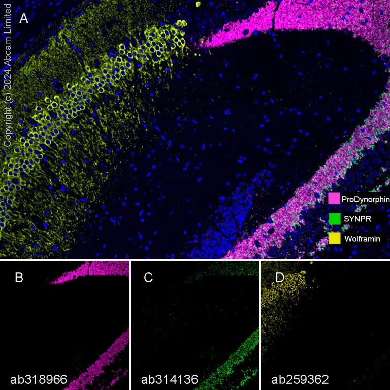 Multiplex immunohistochemistry - Anti-ProDynorphin antibody [EPR28632-48] (AB318966)