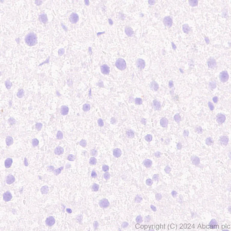 Immunohistochemistry (Formalin/PFA-fixed paraffin-embedded sections) - Anti-ProDynorphin antibody [EPR28632-48] - BSA and Azide free (AB318967)