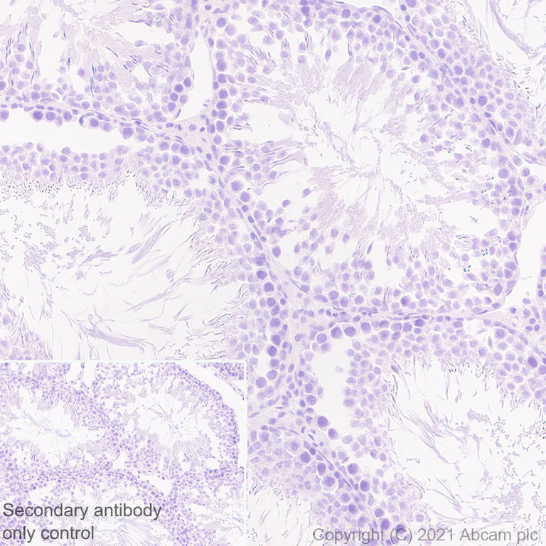 Immunohistochemistry (Formalin/PFA-fixed paraffin-embedded sections) - Anti-Proenkephalin-B antibody [EPR24508-29] (AB282574)