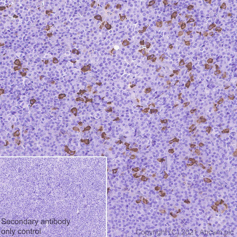 Immunohistochemistry (Formalin/PFA-fixed paraffin-embedded sections) - Anti-Proenkephalin-B antibody [EPR24508-78] (AB283501)