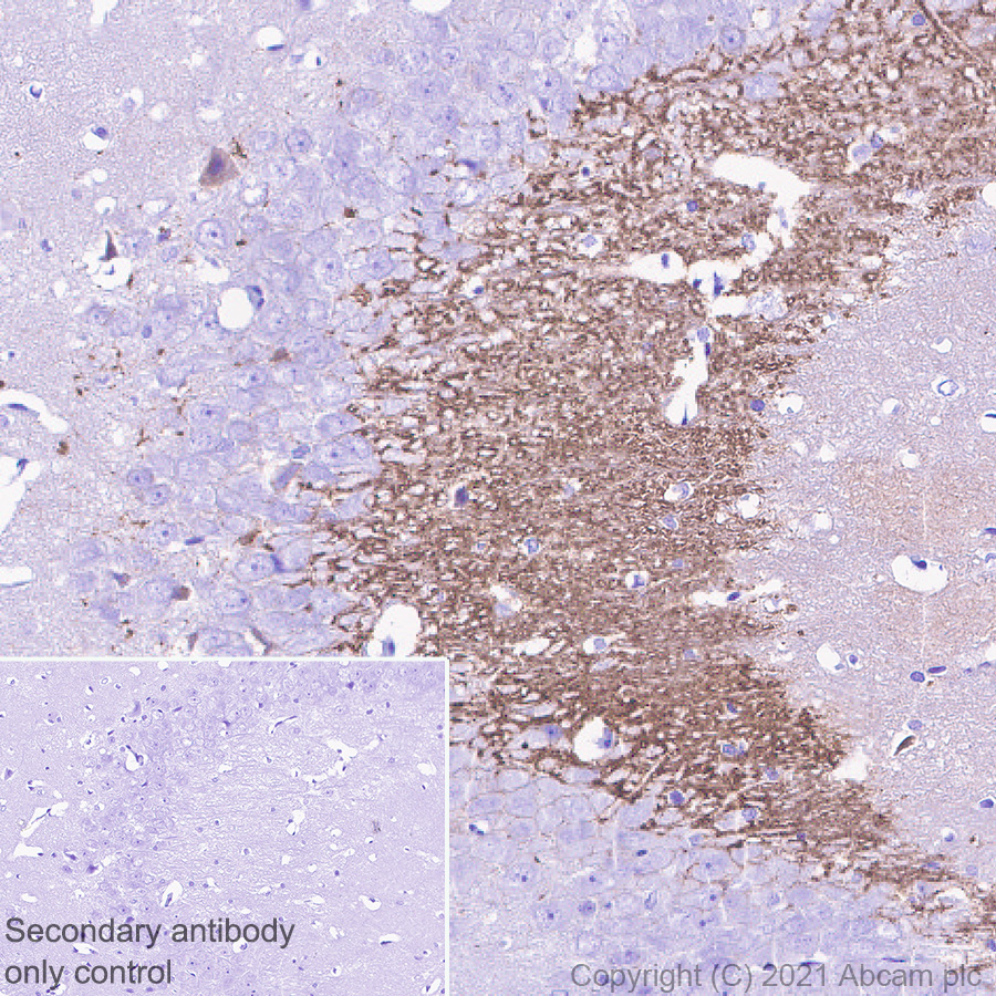 Immunohistochemistry (Formalin/PFA-fixed paraffin-embedded sections) - Anti-Proenkephalin-B antibody [EPR24508-78] (AB283501), expandable thumbnail