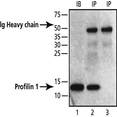 Immunoprecipitation - Anti-Profilin 1 antibody - Carboxyterminal end (AB50667), expandable thumbnail