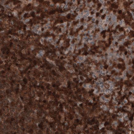 Immunohistochemistry (Formalin/PFA-fixed paraffin-embedded sections) - Anti-Profilin 1 antibody [CL3524] (AB242369), expandable thumbnail