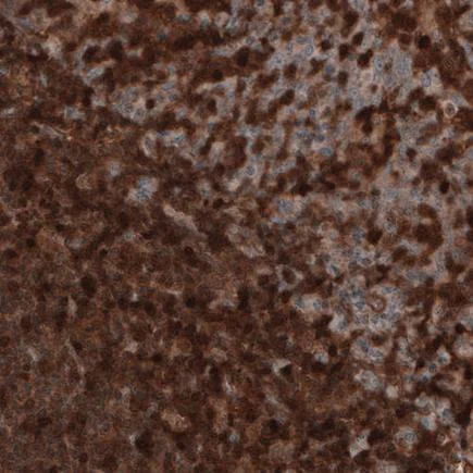 Immunohistochemistry (Formalin/PFA-fixed paraffin-embedded sections) - Anti-Profilin 1 antibody [CL3524] (AB242369)