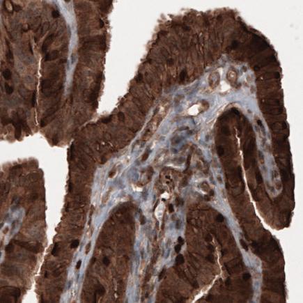 Immunohistochemistry (Formalin/PFA-fixed paraffin-embedded sections) - Anti-Profilin 1 antibody [CL3524] (AB242369), expandable thumbnail
