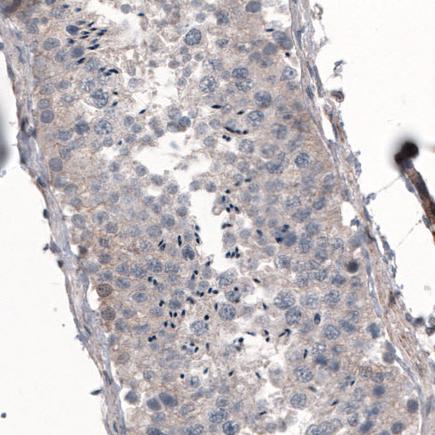 Immunohistochemistry (Formalin/PFA-fixed paraffin-embedded sections) - Anti-Profilin 1 antibody [CL3524] (ab242369), expandable thumbnail