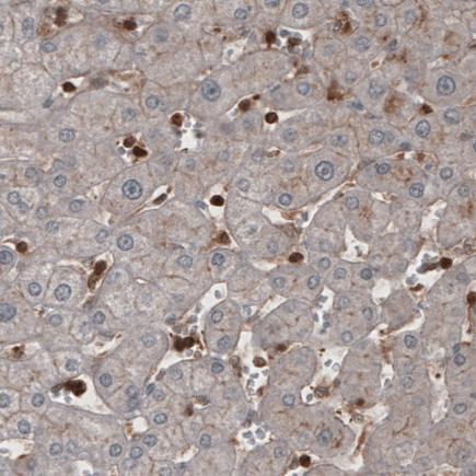 Immunohistochemistry (Formalin/PFA-fixed paraffin-embedded sections) - Anti-Profilin 1 antibody [CL3524] (AB242369), expandable thumbnail