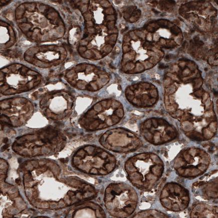 Immunohistochemistry (Formalin/PFA-fixed paraffin-embedded sections) - Anti-Profilin 1 antibody [CL3524] (AB242369), expandable thumbnail