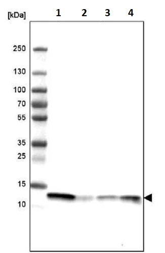 Western blot - Anti-Profilin 1 antibody [CL3524] (AB242369)